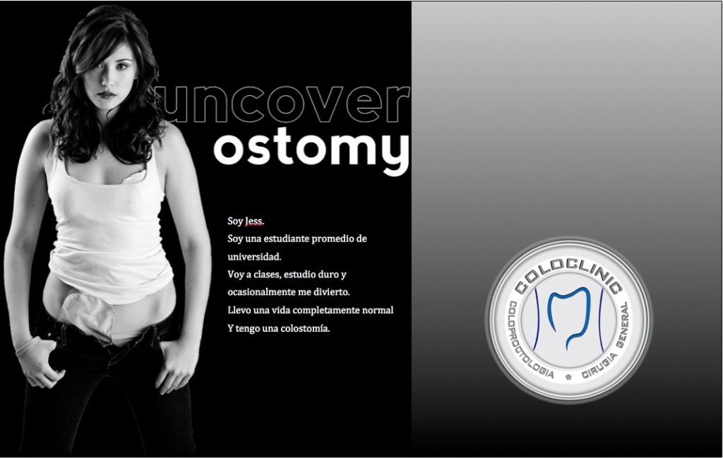 Una colostomía es una técnica quirúrgica que puede salvar o mejorar la vida de una persona; sin embargo también significa un cambio radical para la vida de esa persona. Nosotros somos de los pocos especialistas que pueden ayudarle con esto.