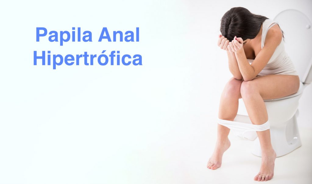 Una Papila Anal Hipertrófica es un tumor benigno que se encuentra dentro del ano y que sale al momento de evacuar con lo que se inflaman, duelen o sangran, aunque muchas son asintomáticas. Muchas personas las confunden con hemorroides.