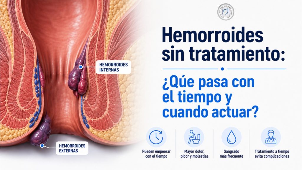 Hemorroides sin tratamiento: qué pasa con el tiempo y cuándo actuar
